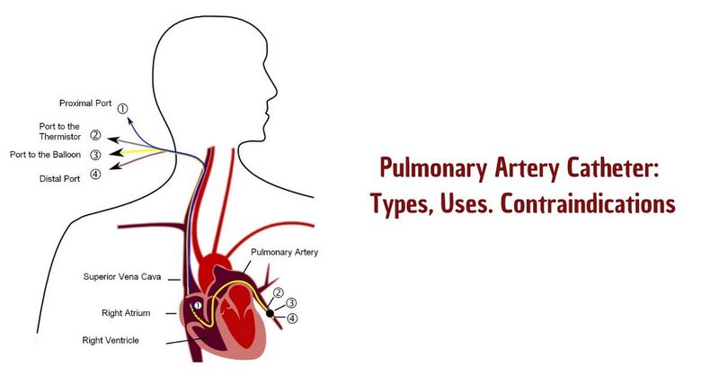 Pulmonary Artery Catheter