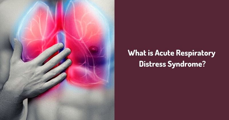 What is Acute Respiratory Distress Syndrome_