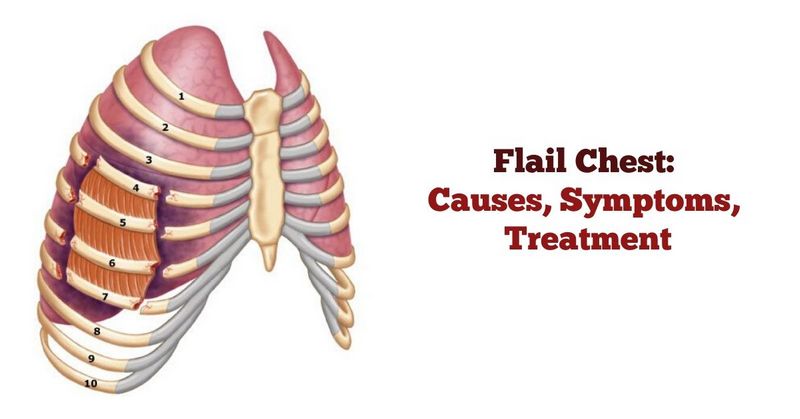 Flail Chest